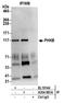 Phosphorylase Kinase Regulatory Subunit Beta antibody, A304-881A, Bethyl Labs, Immunoprecipitation image 