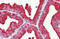Acid Phosphatase, Prostate antibody, AP21364AF-N, Origene, Immunohistochemistry frozen image 