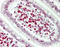 Telomeric Repeat Binding Factor 2 antibody, LS-B12052, Lifespan Biosciences, Immunohistochemistry paraffin image 