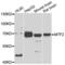 Metal Response Element Binding Transcription Factor 2 antibody, LS-C346218, Lifespan Biosciences, Western Blot image 