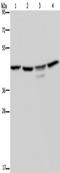 Casein Kinase 2 Alpha 1 antibody, TA323095, Origene, Western Blot image 