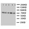Sphingosine-1-Phosphate Receptor 5 antibody, LS-C313102, Lifespan Biosciences, Western Blot image 