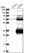 Leucine Rich Repeat Containing 3 antibody, PA5-53685, Invitrogen Antibodies, Western Blot image 