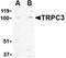Transient Receptor Potential Cation Channel Subfamily C Member 3 antibody, orb74749, Biorbyt, Western Blot image 