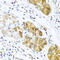 C-C Motif Chemokine Ligand 8 antibody, A03237, Boster Biological Technology, Immunohistochemistry paraffin image 