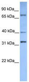 SUZ12 Polycomb Repressive Complex 2 Subunit antibody, TA330578, Origene, Western Blot image 