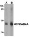 Calcium Release Activated Channel Regulator 2B antibody, LS-B5350, Lifespan Biosciences, Western Blot image 