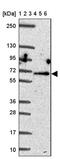 Amine oxidase [flavin-containing] A antibody, PA5-63700, Invitrogen Antibodies, Western Blot image 