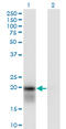 Ubiquitin Conjugating Enzyme E2 H antibody, LS-C198397, Lifespan Biosciences, Western Blot image 