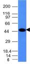 Keratin 8 antibody, GTX34663, GeneTex, Western Blot image 