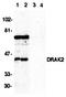 Membrane Palmitoylated Protein 5 antibody, orb18856, Biorbyt, Western Blot image 
