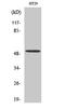 Hepatocyte Nuclear Factor 4 Alpha antibody, STJ93554, St John