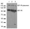Insulin Like Growth Factor 1 Receptor antibody, AP02787PU-S, Origene, Western Blot image 