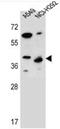 Protein Phosphatase 1 Regulatory Subunit 42 antibody, AP52545PU-N, Origene, Western Blot image 