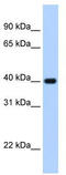 Zinc Finger And SCAN Domain Containing 26 antibody, TA330104, Origene, Western Blot image 