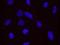Pim-1 Proto-Oncogene, Serine/Threonine Kinase antibody, NB100-2313, Novus Biologicals, Proximity Ligation Assay image 