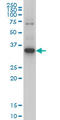 Zinc finger protein ZIC 4 antibody, LS-C105185, Lifespan Biosciences, Western Blot image 