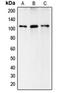 Complement C6 antibody, orb213624, Biorbyt, Western Blot image 