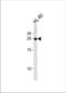 Homeobox A6 antibody, TA324460, Origene, Western Blot image 