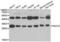N(Alpha)-Acetyltransferase 10, NatA Catalytic Subunit antibody, LS-C346180, Lifespan Biosciences, Western Blot image 