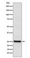 Tubulin Polymerization Promoting Protein antibody, M04389-1, Boster Biological Technology, Western Blot image 