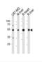 Alanine aminotransferase 1 antibody, abx033420, Abbexa, Western Blot image 