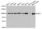 Pre-MRNA Processing Factor 3 antibody, LS-C334081, Lifespan Biosciences, Western Blot image 