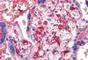 Platelet Factor 4 antibody, NBP1-50290, Novus Biologicals, Immunohistochemistry frozen image 