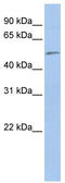 Eukaryotic translation initiation factor 5 antibody, TA337602, Origene, Western Blot image 
