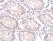 Protein-tyrosine kinase 7 antibody, 4299, ProSci, Immunohistochemistry frozen image 