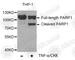 Poly(ADP-Ribose) Polymerase 1 antibody, A2432, ABclonal Technology, Western Blot image 