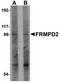 FERM And PDZ Domain Containing 2 antibody, TA306863, Origene, Western Blot image 
