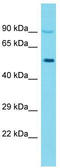 Keratin 26 antibody, TA337398, Origene, Western Blot image 