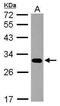 Proteasome 20S beta7 subunit antibody, PA5-30988, Invitrogen Antibodies, Western Blot image 