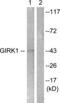 Potassium Voltage-Gated Channel Subfamily J Member 3 antibody, LS-C117945, Lifespan Biosciences, Western Blot image 