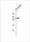 Homeobox protein Hox-B6a antibody, PA5-72662, Invitrogen Antibodies, Western Blot image 