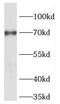 Forkhead Box C1 antibody, FNab03190, FineTest, Western Blot image 