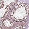 Nudix Hydrolase 1 antibody, PA5-52963, Invitrogen Antibodies, Immunohistochemistry paraffin image 