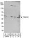 Tumor Susceptibility 101 antibody, A303-507A, Bethyl Labs, Western Blot image 