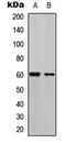 Cell Division Cycle 25C antibody, LS-C358446, Lifespan Biosciences, Western Blot image 