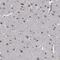 Cytoplasmic tRNA 2-thiolation protein 2 antibody, PA5-59441, Invitrogen Antibodies, Immunohistochemistry frozen image 