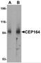Centrosomal Protein 164 antibody, 5083, ProSci, Western Blot image 