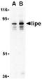 BCL2 antibody, orb4669, Biorbyt, Western Blot image 