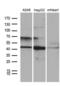 F-Box Protein 22 antibody, LS-C792215, Lifespan Biosciences, Western Blot image 