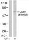 LIM Domain Kinase 1 antibody, TA309980, Origene, Western Blot image 