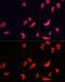 ATPase H+ Transporting V1 Subunit B2 antibody, GTX32461, GeneTex, Immunofluorescence image 