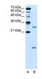 Vacuolar ATPase Assembly Factor VMA21 antibody, orb325184, Biorbyt, Western Blot image 