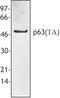 Tumor Protein P63 antibody, LS-C41317, Lifespan Biosciences, Western Blot image 
