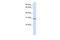 Sushi Domain Containing 6 antibody, PA5-42971, Invitrogen Antibodies, Western Blot image 