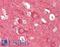 Neuronal Calcium Sensor 1 antibody, LS-B10806, Lifespan Biosciences, Immunohistochemistry paraffin image 